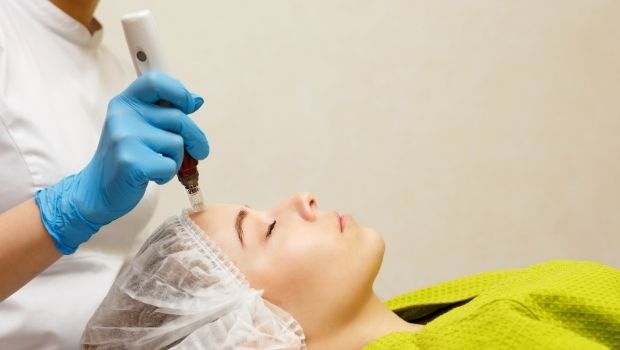 Microneedling