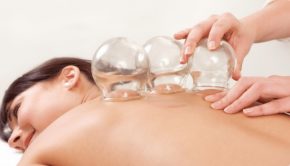 cupping-therapy